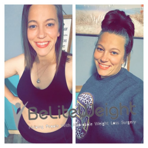 Brittany B - 1 Year After Gastric Sleeve